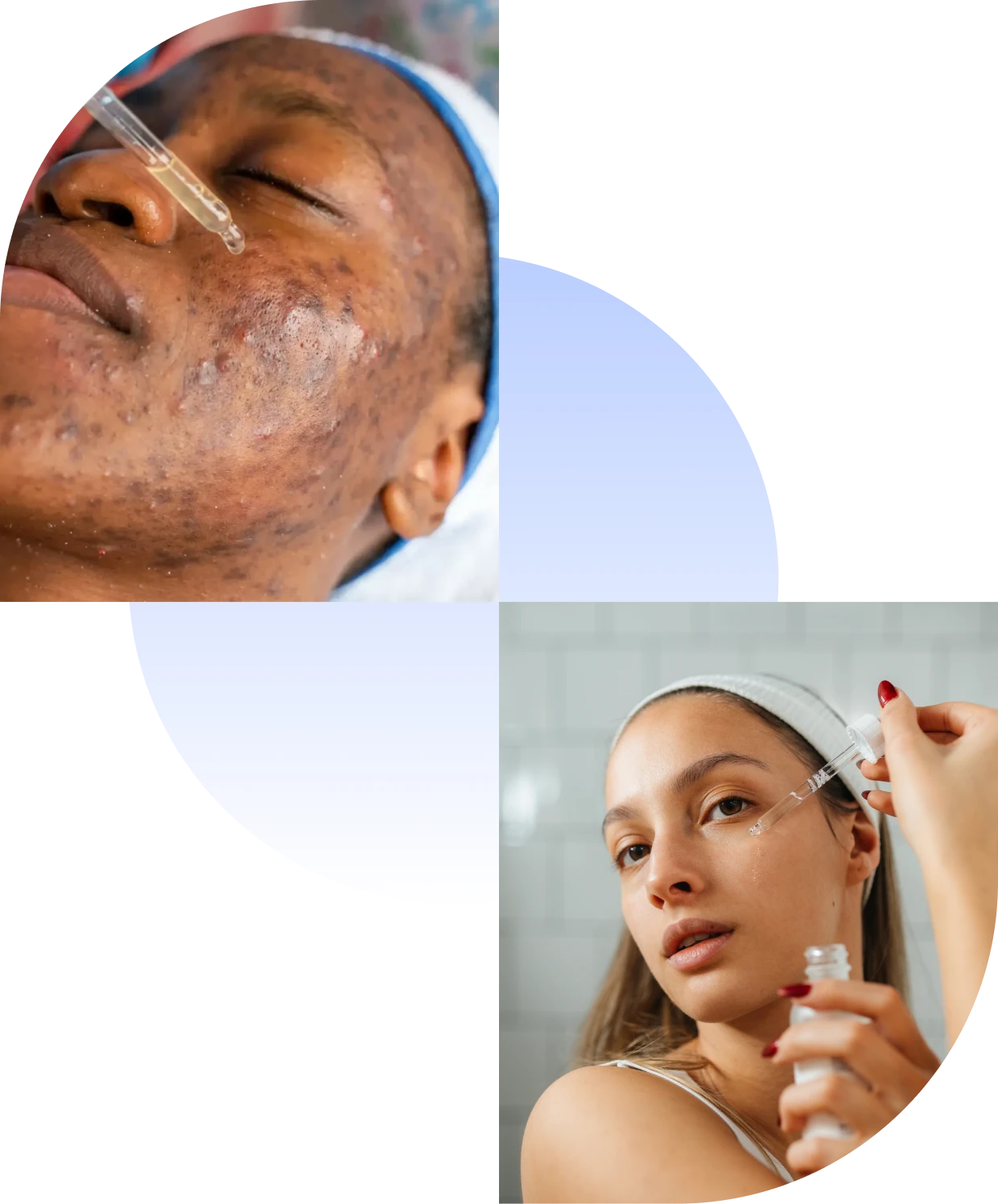 Woman applying face serum