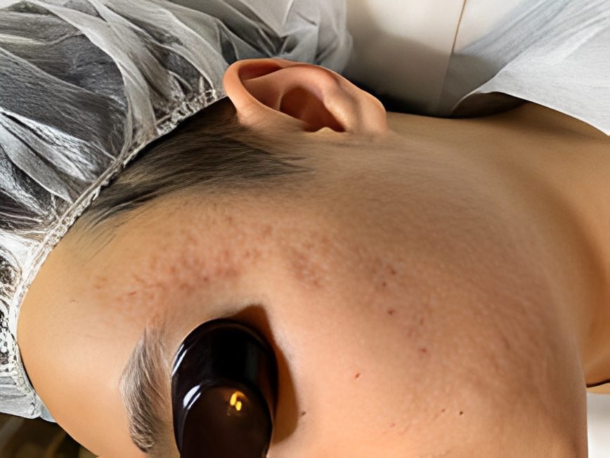 Relaxing skincare treatment underway