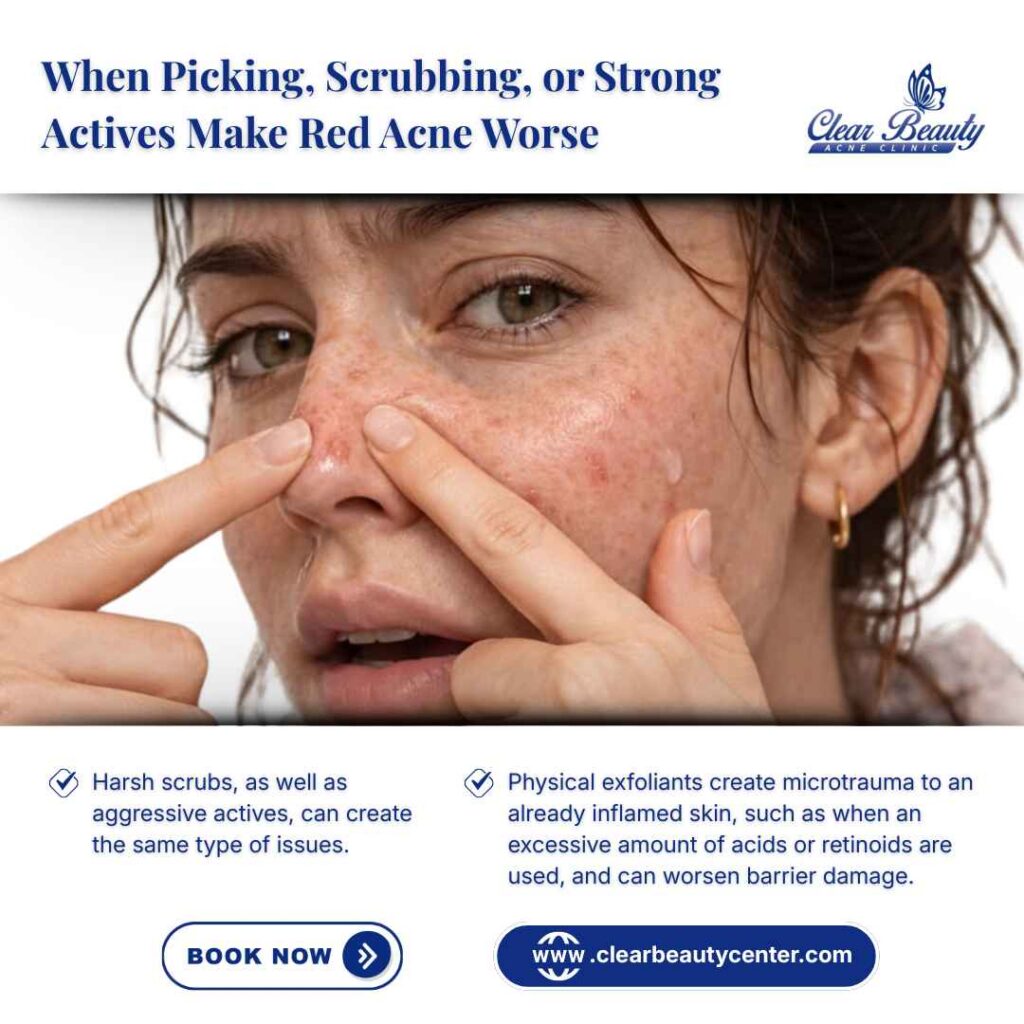 When Picking, Scrubbing, or Strong Actives Make Red Acne Worse
