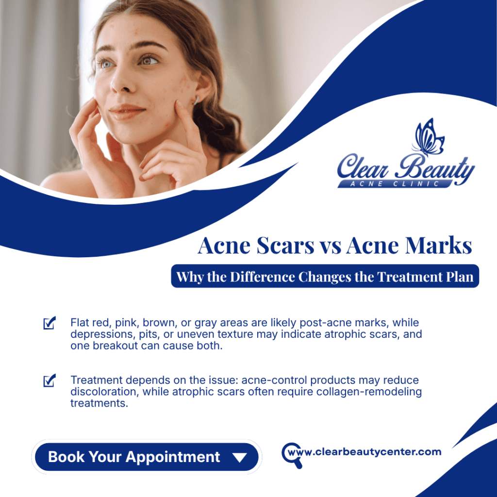 Woman examining acne scars with clinic banner