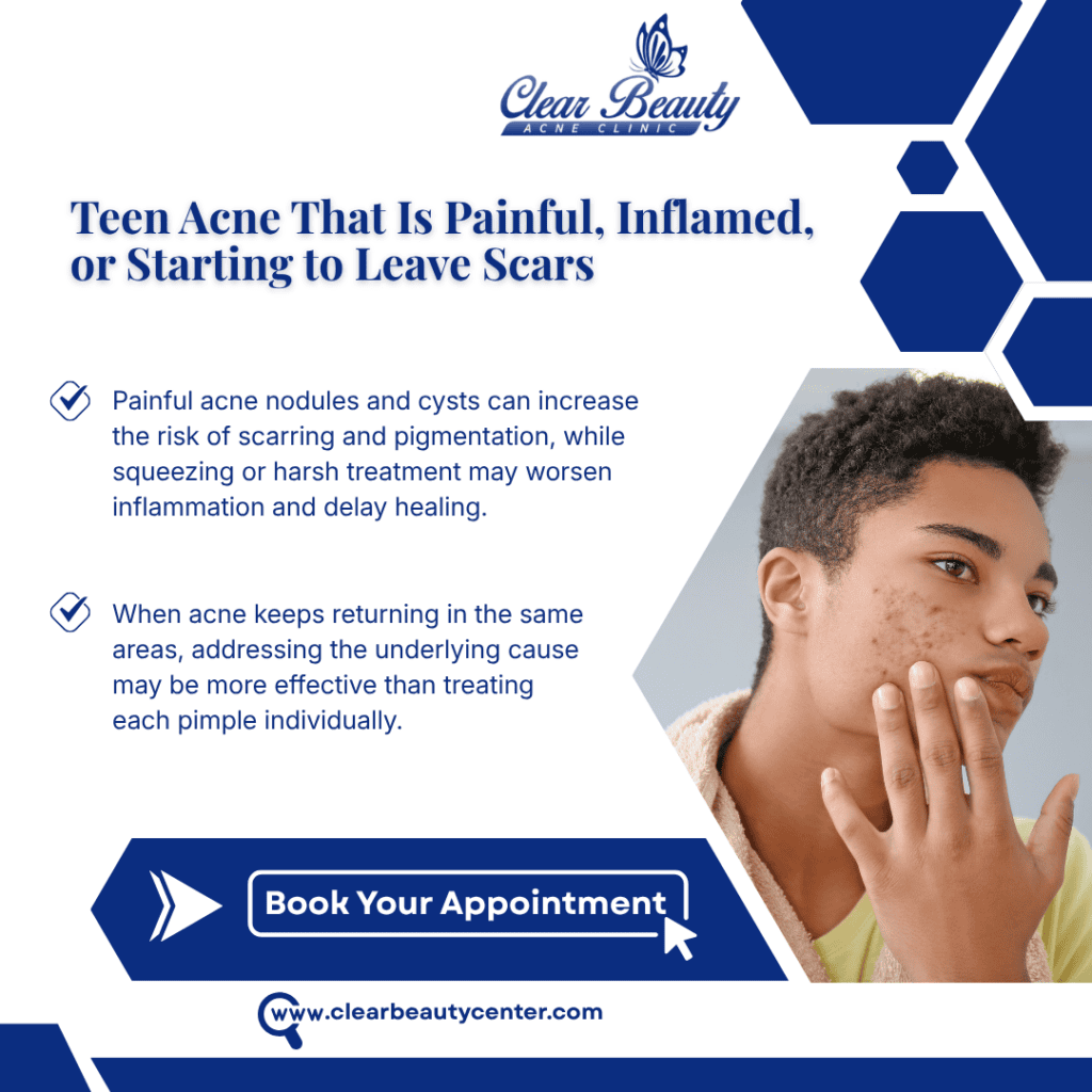 Teen with inflamed acne touching cheek